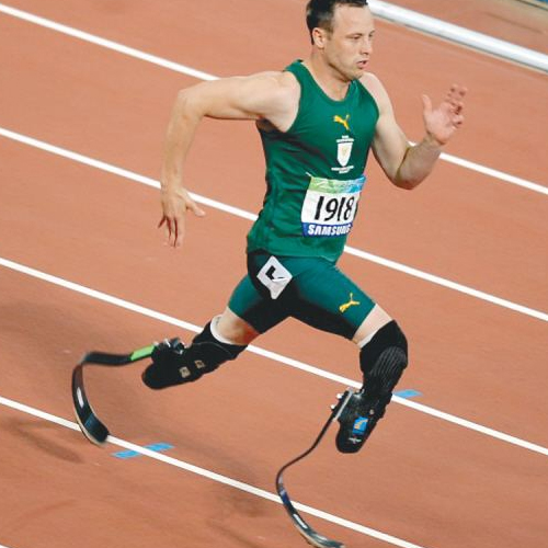 截肢后可以運動訓練么,穿戴河南假肢過程可以跑步么(圖2) 截肢后可以運動訓練么,穿戴河南假肢過程可以跑步么(圖2)