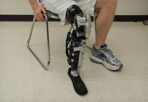 小腿假肢價(jià)格患者穿戴假肢過程中遇到問題如何解決(圖1) 小腿假肢價(jià)格患者穿戴假肢過程中遇到問題如何解決(圖1)